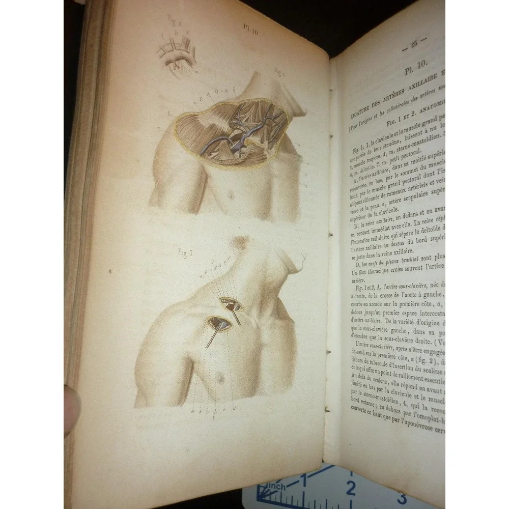 N/A antique medical
